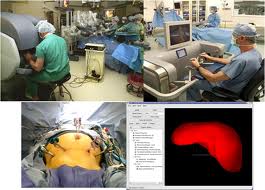 Laparoscopic Surgery in India