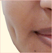 Plastic Surgery India